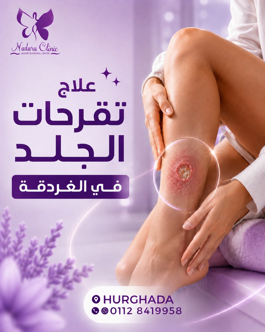 علاج تقرحات الجلد في الغردقة
